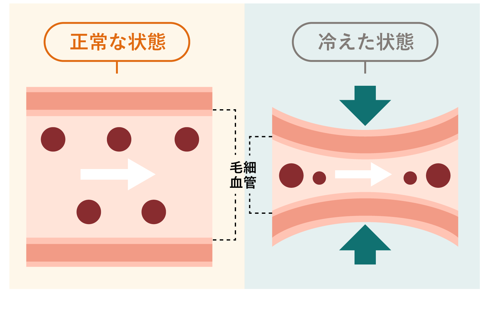 正常な状態と冷えた状態の血管の断面図